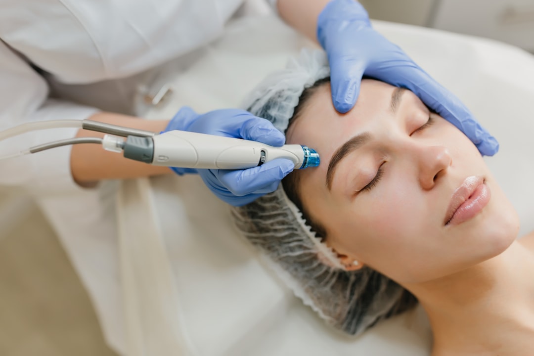 Professional Microneedling with PRP facial treatment in progress